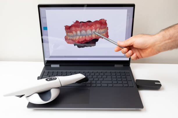 Dental Inlays and Onlays in Greenland, AR